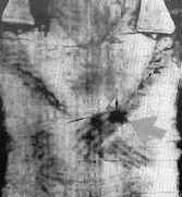 la flèche indique la plaie du poignet (cliché A.Marestoni)