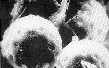 pollens vus au microscope